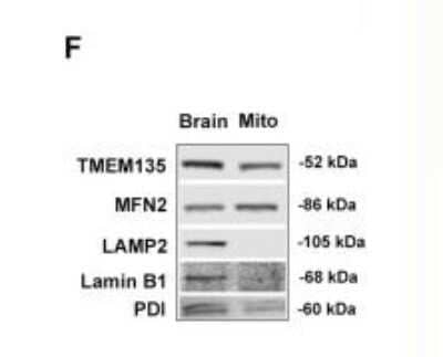 Western Blot: LAMP-2/CD107b Antibody (H4B4)Azide and BSA Free [NBP2-80825]