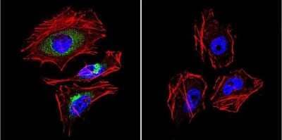 Immunocytochemistry/ Immunofluorescence: LAMP-2/CD107b Antibody [NB300-591]