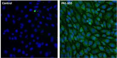 Immunocytochemistry/ Immunofluorescence: LAMP-2/CD107b Antibody [NB300-591]