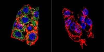 Immunocytochemistry/ Immunofluorescence: LAMP-2/CD107b Antibody [NB300-591]