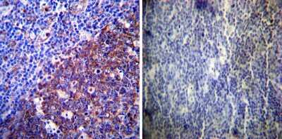 Immunohistochemistry-Paraffin: LAMP-2/CD107b Antibody [NB300-591]