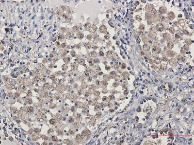 Immunohistochemistry-Paraffin: LAMP-2/CD107b Antibody (S03-0B5) [NBP3-19884]