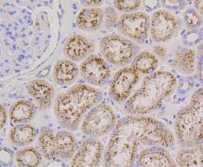 Immunohistochemistry-Paraffin: LAMP-2/CD107b Antibody (SA46-01) [NBP2-67298]