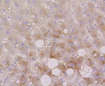 Immunohistochemistry-Paraffin: LAMP-2/CD107b Antibody (SA46-01) [NBP2-67298]