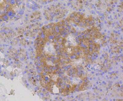 Immunohistochemistry-Paraffin: LAMP-2/CD107b Antibody (SA46-01) [NBP2-67298]