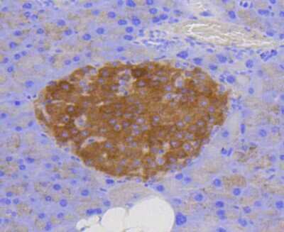 Immunohistochemistry-Paraffin: LAMP-2/CD107b Antibody (SA46-01) [NBP2-67298]