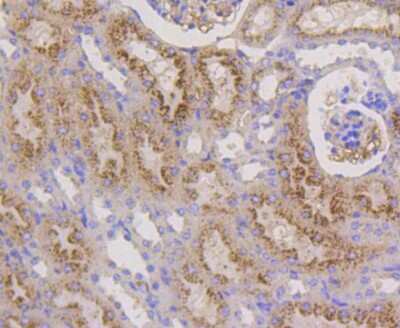 Immunohistochemistry-Paraffin: LAMP-2/CD107b Antibody (SA46-01) [NBP2-67298]
