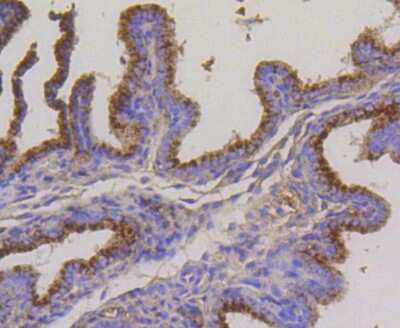 Immunohistochemistry-Paraffin: LAMP-2/CD107b Antibody (SA46-01) [NBP2-67298]