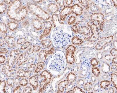 Immunohistochemistry-Paraffin: LAMP-2/CD107b Antibody (SA46-01) [NBP2-67298]