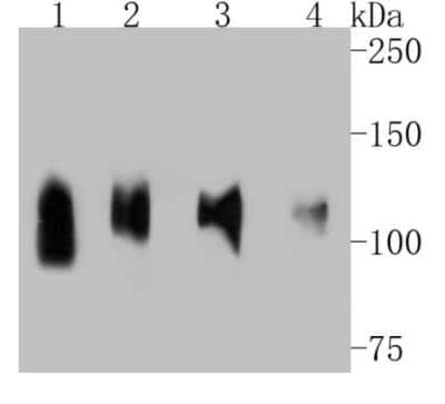Western Blot: LAMP-2/CD107b Antibody (SA46-01) [NBP2-67298]