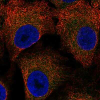 Immunocytochemistry/ Immunofluorescence: LAMP Antibody [NBP2-55960]