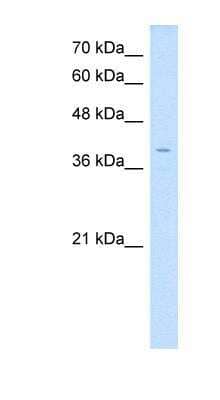 Western Blot: LAMP Antibody [NBP1-59212]