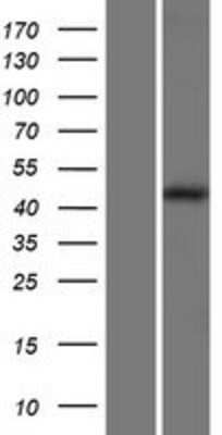 Western Blot: LAMP-1/CD107a Overexpression Lysate [NBP2-07733]