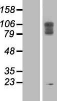 Western Blot: LAMP-2/CD107b Overexpression Lysate [NBP2-08128]