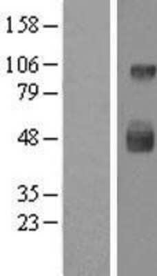 Western Blot: DC-LAMP Overexpression Lysate [NBL1-12432]