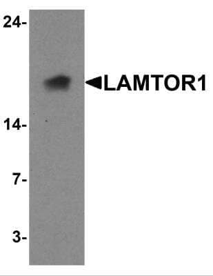 Western Blot: LAMTOR1 AntibodyBSA Free [NBP2-82075]