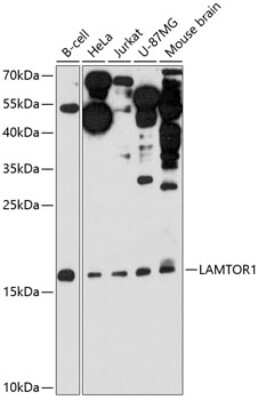 Western Blot: LAMTOR1 AntibodyAzide and BSA Free [NBP3-04465]