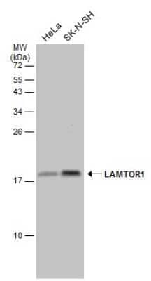 Western Blot: LAMTOR1 Antibody [NBP3-13256]