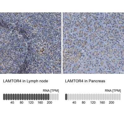 Immunohistochemistry-Paraffin: LAMTOR4 Antibody [NBP1-90936]