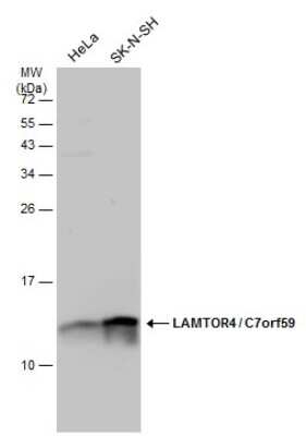 Western Blot: LAMTOR4 Antibody [NBP3-13257]