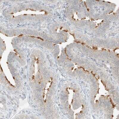 Immunohistochemistry-Paraffin: LANCL1 Antibody [NBP1-81796]