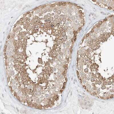 Immunohistochemistry-Paraffin: LANCL1 Antibody [NBP1-81796]