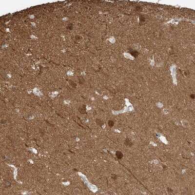 Immunohistochemistry-Paraffin: LANCL1 Antibody [NBP1-81796]