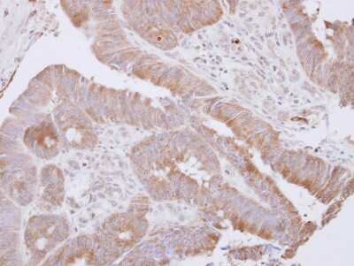 Immunohistochemistry-Paraffin: LANCL1 Antibody [NBP2-19329]