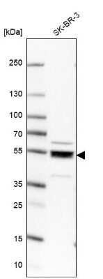 Western Blot: LANCL1 Antibody [NBP1-81796]