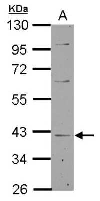 Western Blot: LANCL1 Antibody [NBP2-19329]