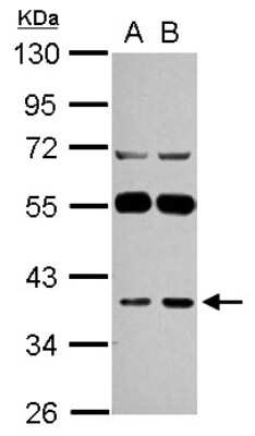 Western Blot: LANCL1 Antibody [NBP2-19330]