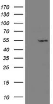 Western Blot: LANCL2 Antibody (OTI1C5) [NBP2-45611]