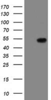 Western Blot: LANCL2 Antibody (OTI2A11) [NBP2-03893]