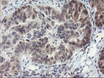 Immunohistochemistry: LANCL2 Antibody (OTI2A11) - Azide and BSA Free [NBP2-72053]