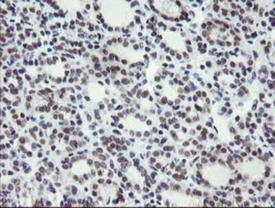 Immunohistochemistry: LANCL2 Antibody (OTI2A11) - Azide and BSA Free [NBP2-72053]
