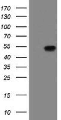 Western Blot: LANCL2 Antibody (OTI2A11)Azide and BSA Free [NBP2-72053]