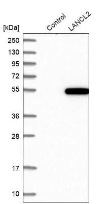 Western Blot: LANCL2 Antibody [NBP1-83339]