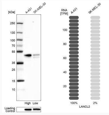 Western Blot: LANCL2 Antibody [NBP1-83340]