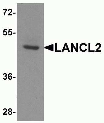 Western Blot: LANCL2 AntibodyBSA Free [NBP2-81845]