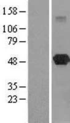 Western Blot: LANCL2 Overexpression Lysate [NBL1-12434]