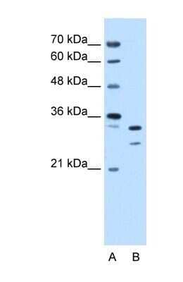 Western Blot: LANPL Antibody [NBP1-56294]