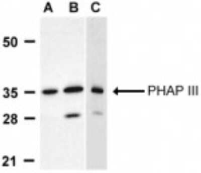 Western Blot: LANPL AntibodyBSA Free [NBP1-77227]