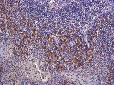 Immunohistochemistry: LAP (TGF-beta 1) Antibody (7F6) - Azide and BSA Free [NBP2-80827]