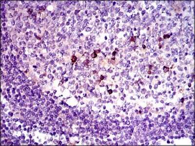 Immunohistochemistry: LAP (TGF-beta 1) Antibody (7F6) - Azide and BSA Free [NBP2-80827]