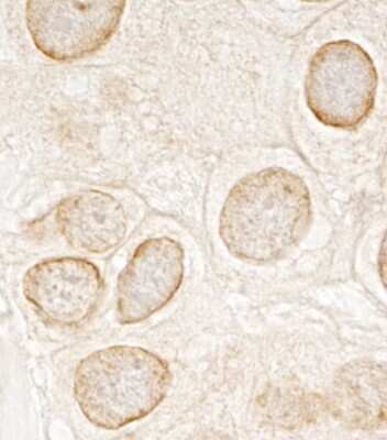 Immunohistochemistry: LAP1B Antibody [NBP1-19123]