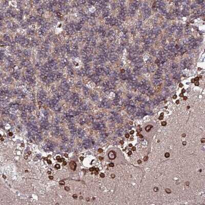 Immunohistochemistry-Paraffin: LAP1B Antibody [NBP2-47402]