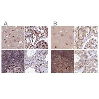 Immunohistochemistry-Paraffin: LAP1B Antibody [NBP2-47402]