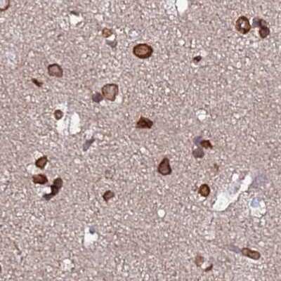 Immunohistochemistry-Paraffin: LAP1B Antibody [NBP2-47402]
