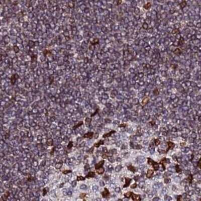Immunohistochemistry-Paraffin: LAP1B Antibody [NBP2-47402]