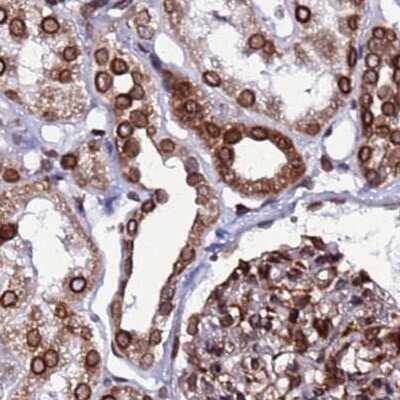 Immunohistochemistry-Paraffin: LAP1B Antibody [NBP2-47402]